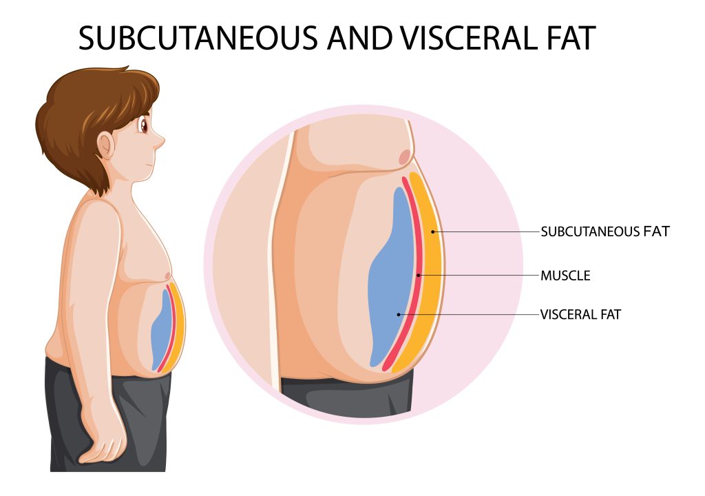 Visceral Fat